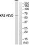 Histamine H4 receptor antibody, TA315696, Origene, Western Blot image 