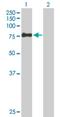 Zinc Finger SWIM-Type Containing 2 antibody, H00151112-B02P, Novus Biologicals, Western Blot image 