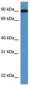 Lysyl oxidase homolog 2 antibody, TA335061, Origene, Western Blot image 