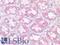 FAS antibody, LS-B12162, Lifespan Biosciences, Immunohistochemistry paraffin image 