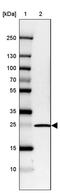 Defective In Cullin Neddylation 1 Domain Containing 5 antibody, PA5-62257, Invitrogen Antibodies, Western Blot image 