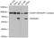 Ran GTPase Activating Protein 1 antibody, 19-628, ProSci, Western Blot image 
