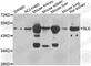 BLK Proto-Oncogene, Src Family Tyrosine Kinase antibody, A7427, ABclonal Technology, Western Blot image 