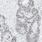 AT-Rich Interaction Domain 1A antibody, NBP1-88932, Novus Biologicals, Immunohistochemistry paraffin image 