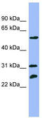 Proteasome 26S Subunit, ATPase 4 antibody, TA345133, Origene, Western Blot image 