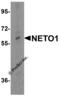 Neuropilin And Tolloid Like 1 antibody, 6469, ProSci, Western Blot image 