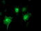 SH2 domain-containing protein 2A antibody, TA504364, Origene, Immunofluorescence image 
