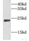 Somatotropin antibody, FNab03659, FineTest, Western Blot image 