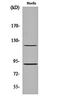Progesterone Receptor antibody, orb159625, Biorbyt, Western Blot image 