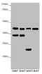 DSN1 Component Of MIS12 Kinetochore Complex antibody, LS-C675665, Lifespan Biosciences, Western Blot image 