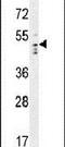 DDB1 And CUL4 Associated Factor 13 antibody, PA5-24324, Invitrogen Antibodies, Western Blot image 
