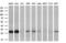 Pyrroline-5-Carboxylate Reductase 3 antibody, GTX83750, GeneTex, Western Blot image 