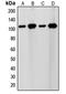 Sentrin-specific protease 7 antibody, LS-C353505, Lifespan Biosciences, Western Blot image 