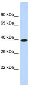 Dematin Actin Binding Protein antibody, TA344235, Origene, Western Blot image 