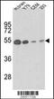 Tubulin Beta 1 Class VI antibody, TA324323, Origene, Western Blot image 
