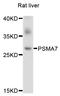 Proteasome Subunit Alpha 7 antibody, STJ25175, St John
