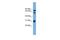 SH3 Domain Containing Kinase Binding Protein 1 antibody, GTX45417, GeneTex, Western Blot image 