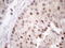 Zinc Finger Protein 200 antibody, M16239, Boster Biological Technology, Immunohistochemistry paraffin image 