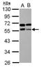 Zinc Finger And BTB Domain Containing 9 antibody, GTX117314, GeneTex, Western Blot image 