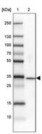 DnaJ Heat Shock Protein Family (Hsp40) Member C8 antibody, PA5-55297, Invitrogen Antibodies, Western Blot image 