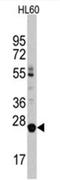 Lin-28 Homolog B antibody, AP11495PU-N, Origene, Western Blot image 