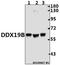 DEAD-Box Helicase 19B antibody, A10099, Boster Biological Technology, Western Blot image 