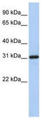 F-Box Protein 16 antibody, TA337798, Origene, Western Blot image 