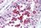 Ring Finger Protein 216 antibody, MBS241344, MyBioSource, Immunohistochemistry paraffin image 