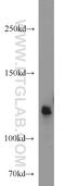 RNA Binding Motif Protein 10 antibody, 14423-1-AP, Proteintech Group, Western Blot image 