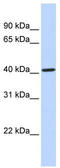 Cytochrome P450 Family 4 Subfamily F Member 12 antibody, TA338640, Origene, Western Blot image 