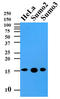 Small Ubiquitin Like Modifier 2 antibody, AM09370PU-S, Origene, Western Blot image 