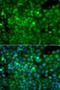POC1 centriolar protein homolog A antibody, LS-C349164, Lifespan Biosciences, Immunofluorescence image 