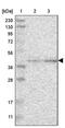Calcium Activated Nucleotidase 1 antibody, PA5-54040, Invitrogen Antibodies, Western Blot image 