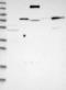 Coiled-Coil Domain Containing 144A antibody, NBP1-93756, Novus Biologicals, Western Blot image 