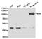 Piwi Like RNA-Mediated Gene Silencing 1 antibody, LS-C193077, Lifespan Biosciences, Western Blot image 