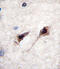 Myocyte-specific enhancer factor 2C antibody, A01131, Boster Biological Technology, Immunohistochemistry paraffin image 