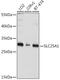Solute Carrier Family 25 Member 1 antibody, GTX64580, GeneTex, Western Blot image 