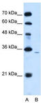 Phospholipid Phosphatase 1 antibody, TA346363, Origene, Western Blot image 