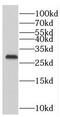 Phosphomannomutase 1 antibody, FNab06573, FineTest, Western Blot image 