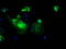 L1 Cell Adhesion Molecule antibody, LS-C175765, Lifespan Biosciences, Immunofluorescence image 
