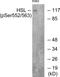 Lipase E, Hormone Sensitive Type antibody, PA5-38254, Invitrogen Antibodies, Western Blot image 