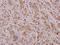 Mme antibody, A01520, Boster Biological Technology, Immunohistochemistry paraffin image 
