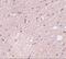 Transmembrane Protein 94 antibody, A15565, Boster Biological Technology, Immunohistochemistry frozen image 