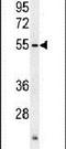 Actin-like protein 7A antibody, PA5-23971, Invitrogen Antibodies, Western Blot image 
