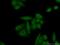 Heterogeneous Nuclear Ribonucleoprotein A2/B1 antibody, 14813-1-AP, Proteintech Group, Immunofluorescence image 
