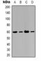 RAC-gamma serine/threonine-protein kinase antibody, orb323208, Biorbyt, Western Blot image 
