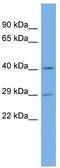 N(Alpha)-Acetyltransferase 60, NatF Catalytic Subunit antibody, TA346700, Origene, Western Blot image 