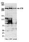 Serine-protein kinase ATM antibody, A300-135A, Bethyl Labs, Western Blot image 