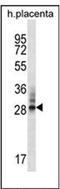 DnaJ Heat Shock Protein Family (Hsp40) Member C27 antibody, AP51295PU-N, Origene, Western Blot image 