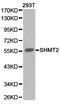 Serine Hydroxymethyltransferase 2 antibody, TA327002, Origene, Western Blot image 